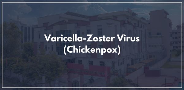 Varicella-Zoster Virus (Chickenpox)